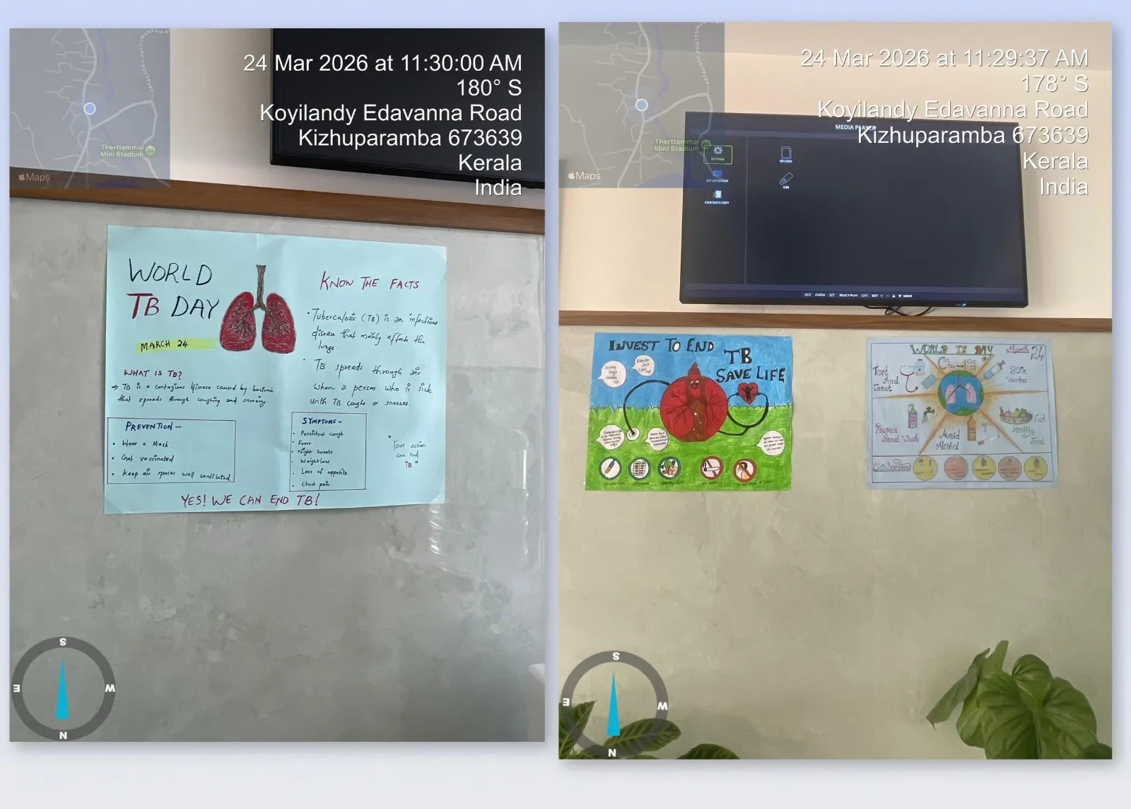 World Tuberculosis (TB) Day at Rivaura Hospital – photo 1