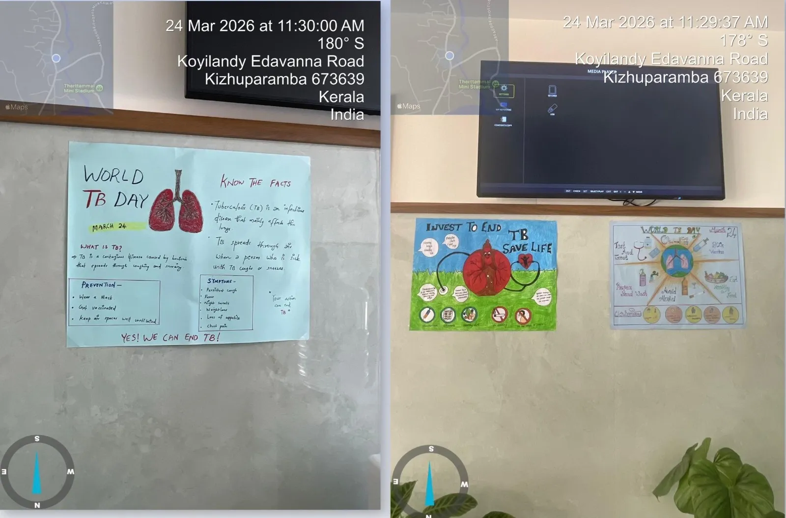 World Tuberculosis (TB) Day at Rivaura Hospital – photo 2