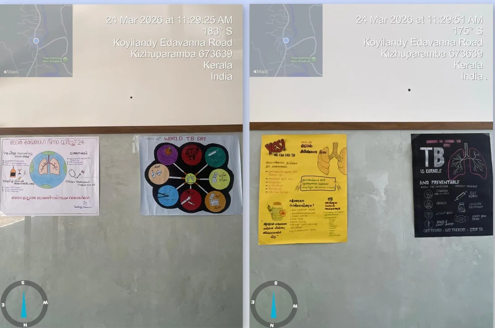 World Tuberculosis (TB) Day at Rivaura Hospital – photo 5